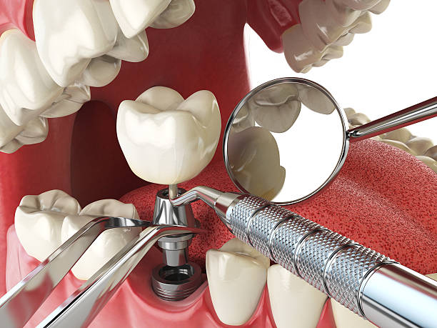 Best Emergency Dentist for Special Needs Patients in Salt Creek Commons, IN